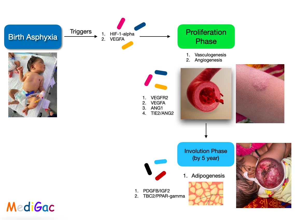 Hemangioma pathophysiology